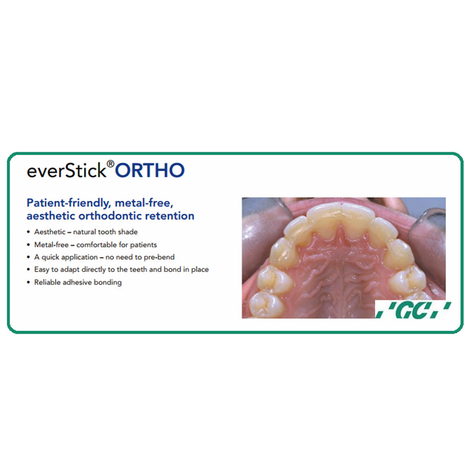 EverStick ORTHO - Glasfaserverstärkung für ästhetische kieferorthopädische Retainer