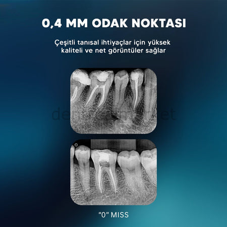 Woodpecker Ai Ray Pro Portable Periapical X-Ray Unit