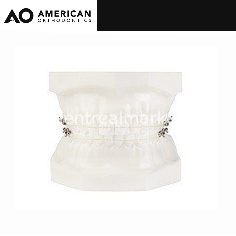 American Orthodontics EverWhite NiTi Cosmetic Round Archwire