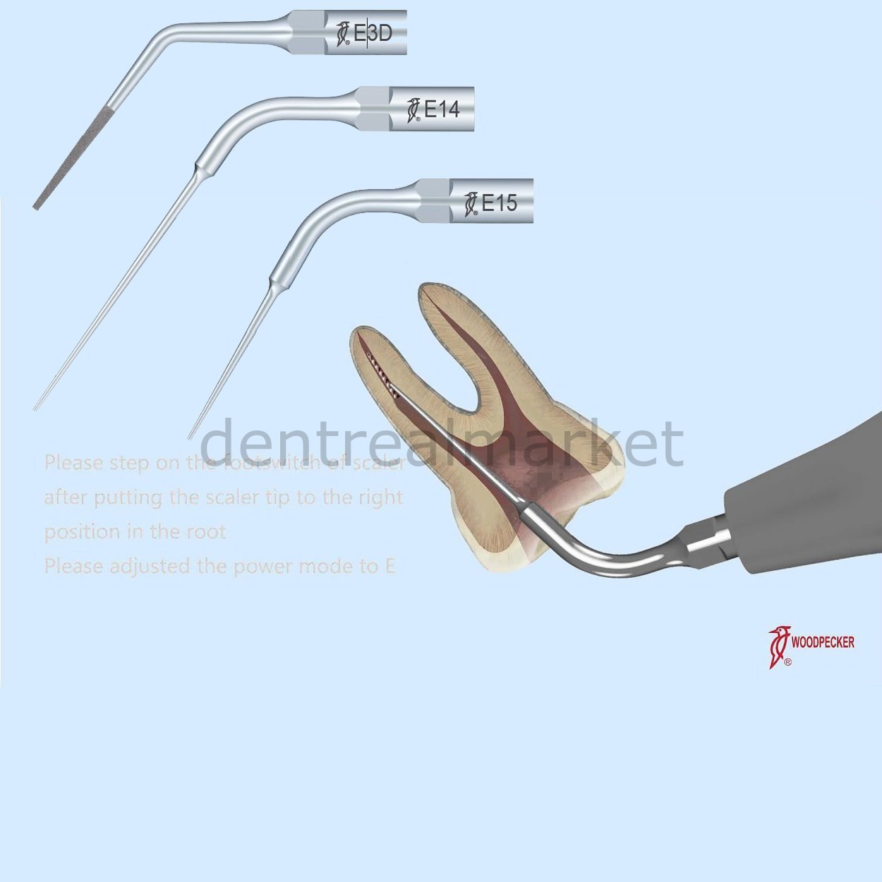 Exctraction File Woodpecker - Broken Canal File Extraction Tips – DentrealStore