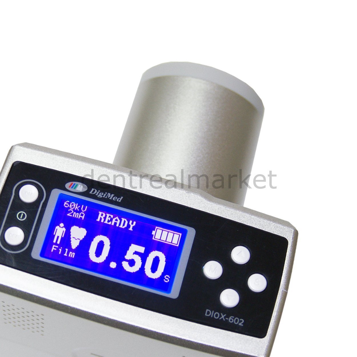 Digimed - Diox Portable Dental DC X-Ray Device – DentrealStore