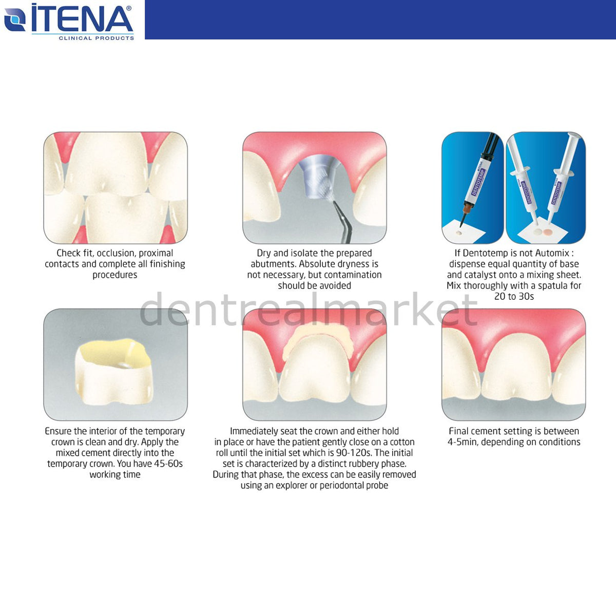 Itena Dentotemp Manual Mix Implant Cement 2 x 12 g