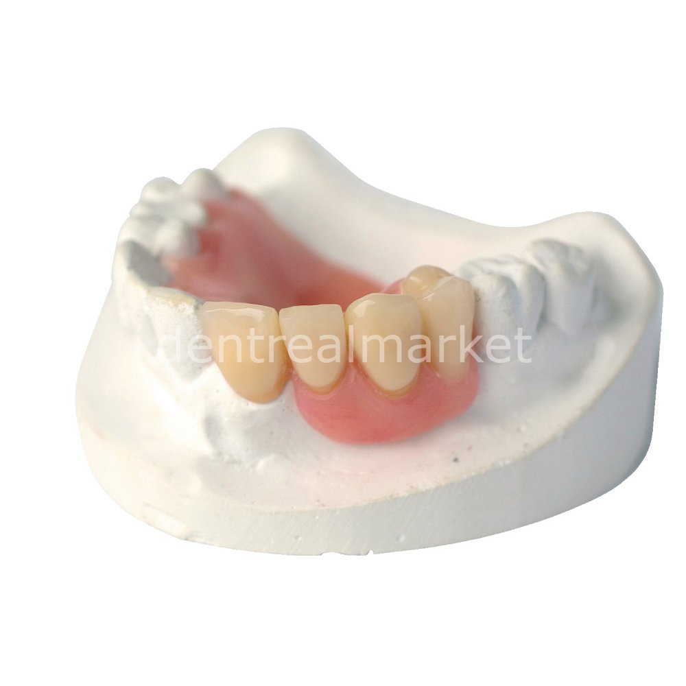 Schottlander Enigmalife+ Nano-Hybrid Composite Denture Teeth — 28-Set