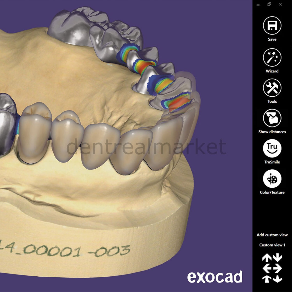 Exocad Dental CAD Software Base Dongle (Crown & Bridge)