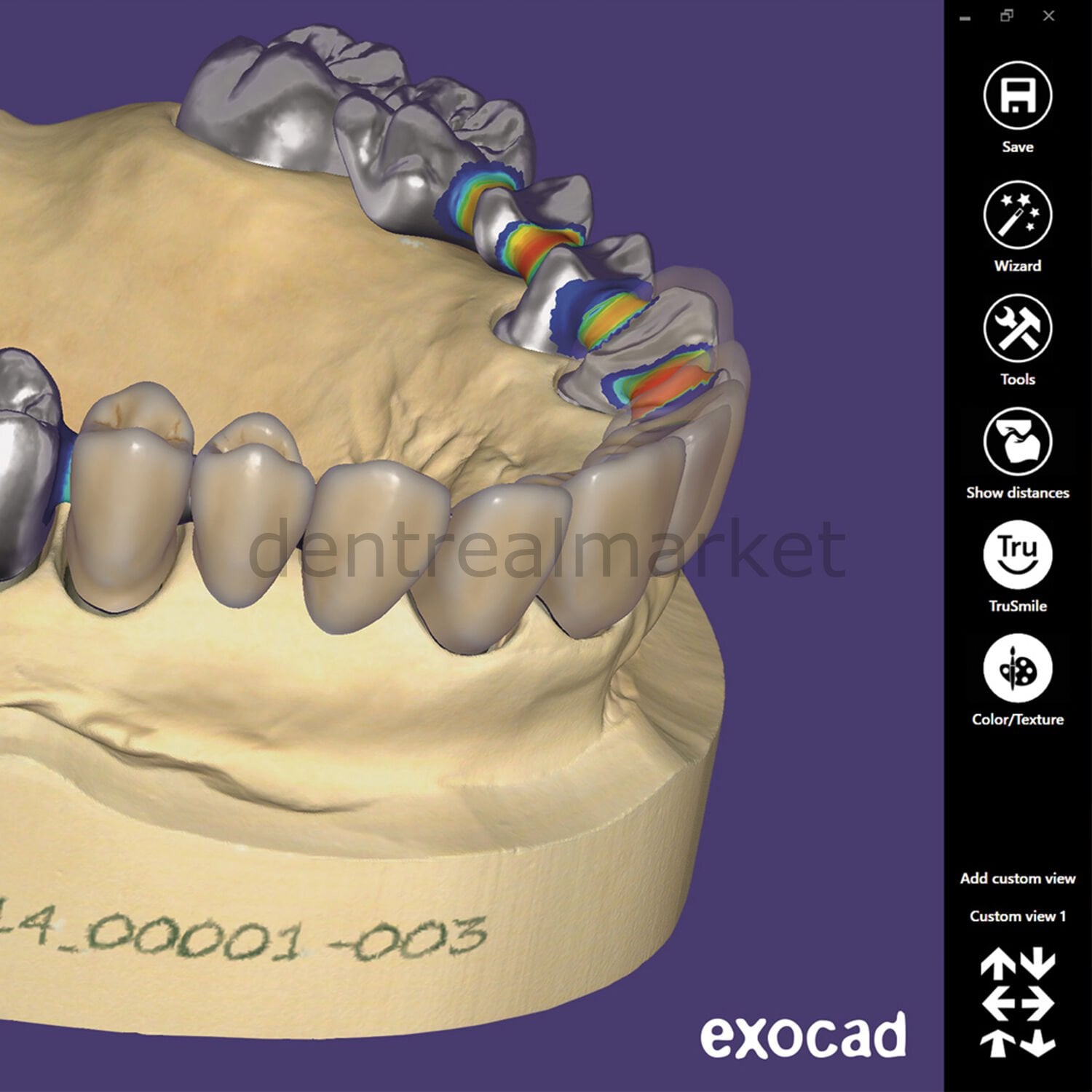 Exocad Dental CAD Software Base Dongle (Crown & Bridge)