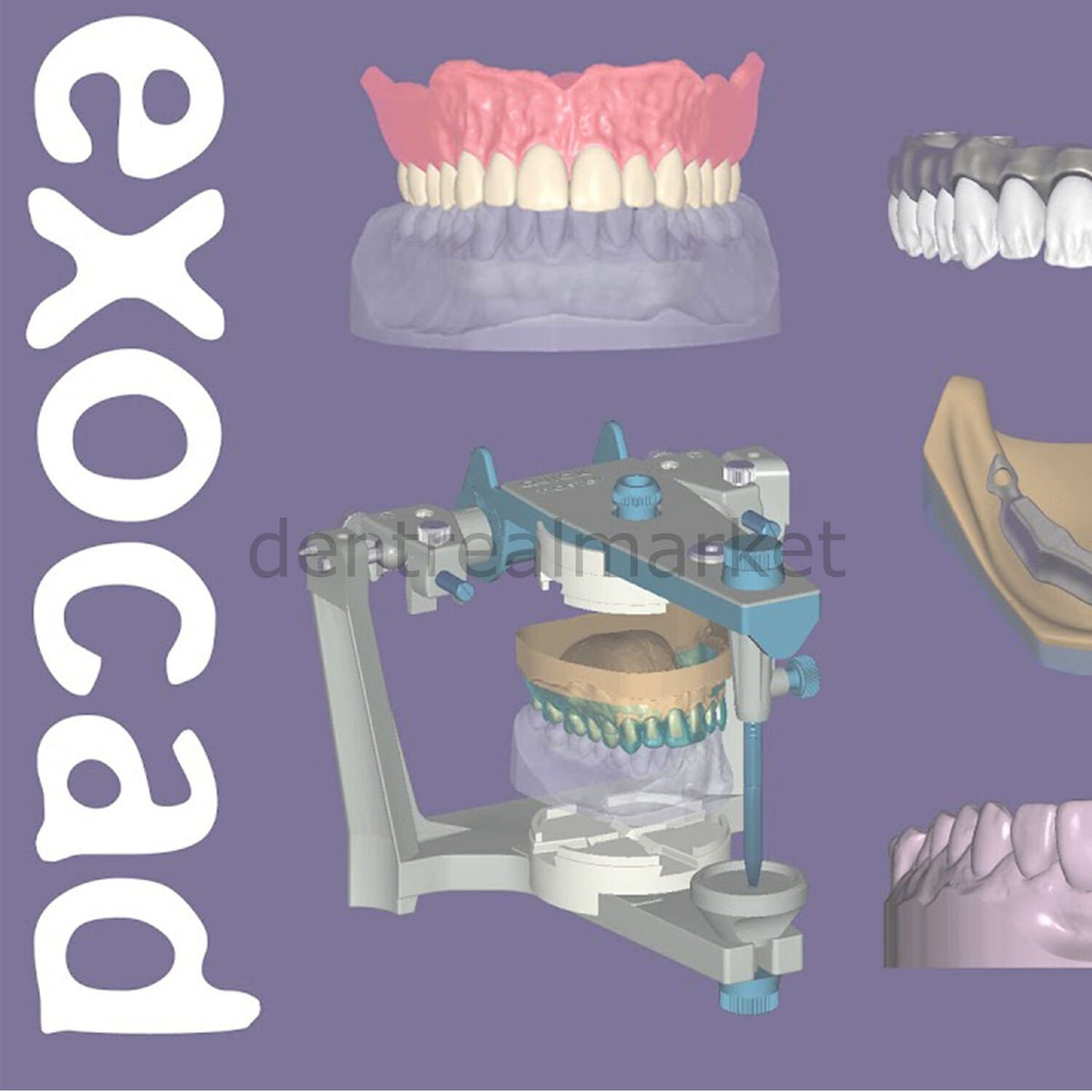 Exocad 3D Dental Design Software — Advanced Lab Bundle