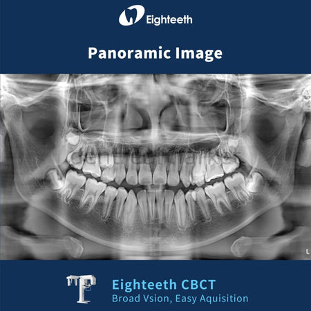 Eighteeth FinScan F350 CBCT with Cephalometric and Panoramic System