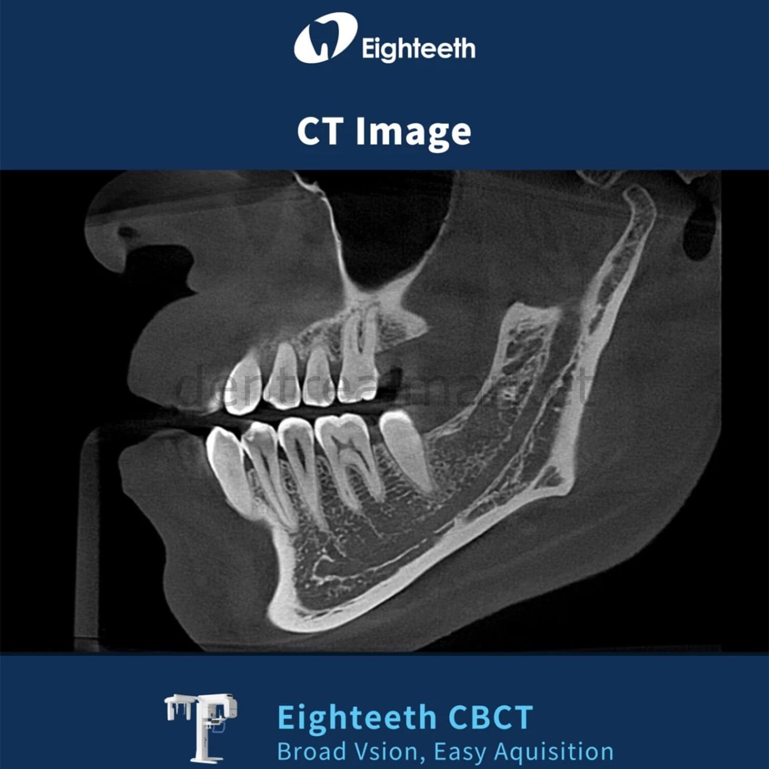 Eighteeth FinScan F350 CBCT with Cephalometric and Panoramic System
