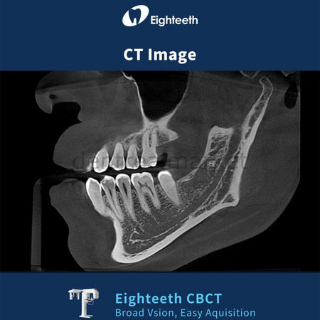 Eighteeth FinScan F350 CBCT with Cephalometric and Panoramic System
