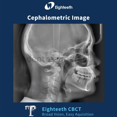 Eighteeth FinScan F350 CBCT with Cephalometric and Panoramic System
