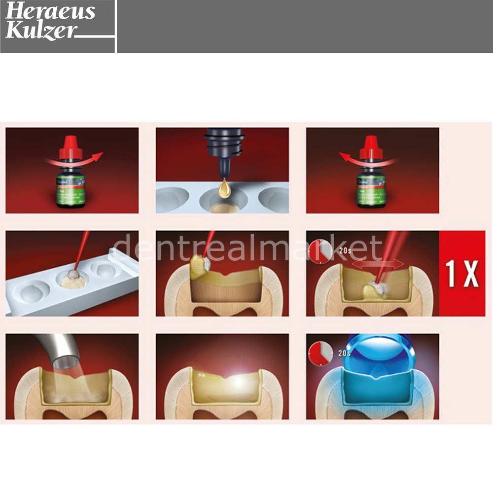 Kulzer GLUMA Self Etch Bond Value Pack