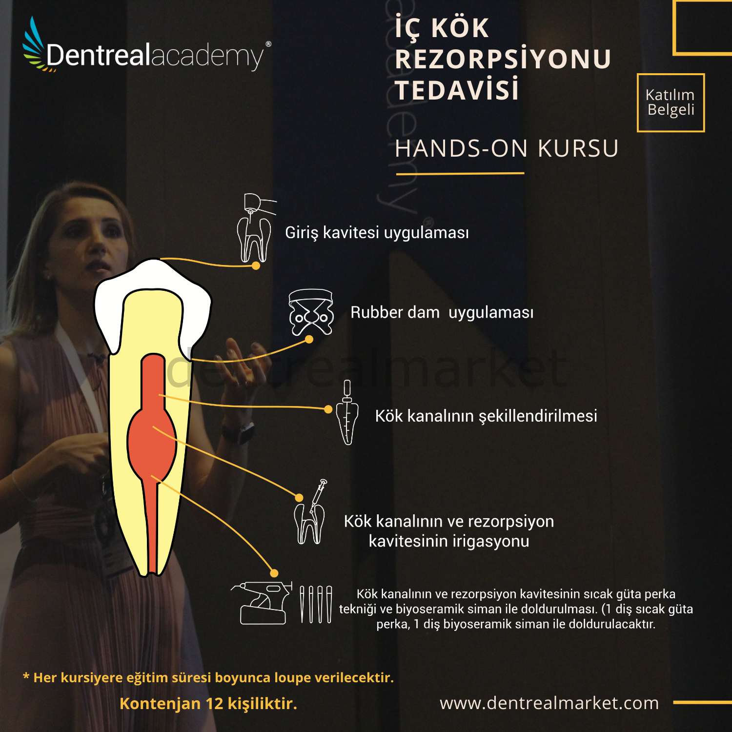 DentrealStore - Dentrealacademy Inner Root Resorption Treatment Hands-On Course