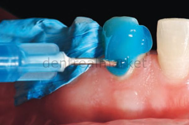 Septodont SeptoTape Protective Isolation Tape