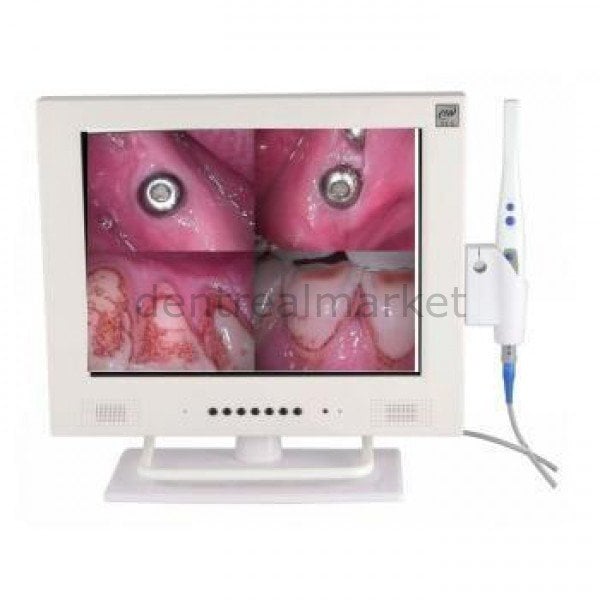 Super Cam M-958 Intraoral Camera and Monitor