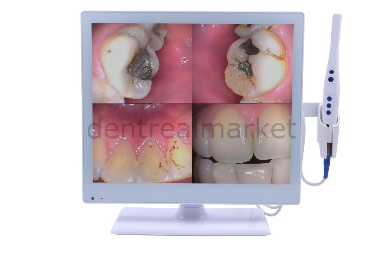 Super Cam M-978 Intraoral Camera and Monitor