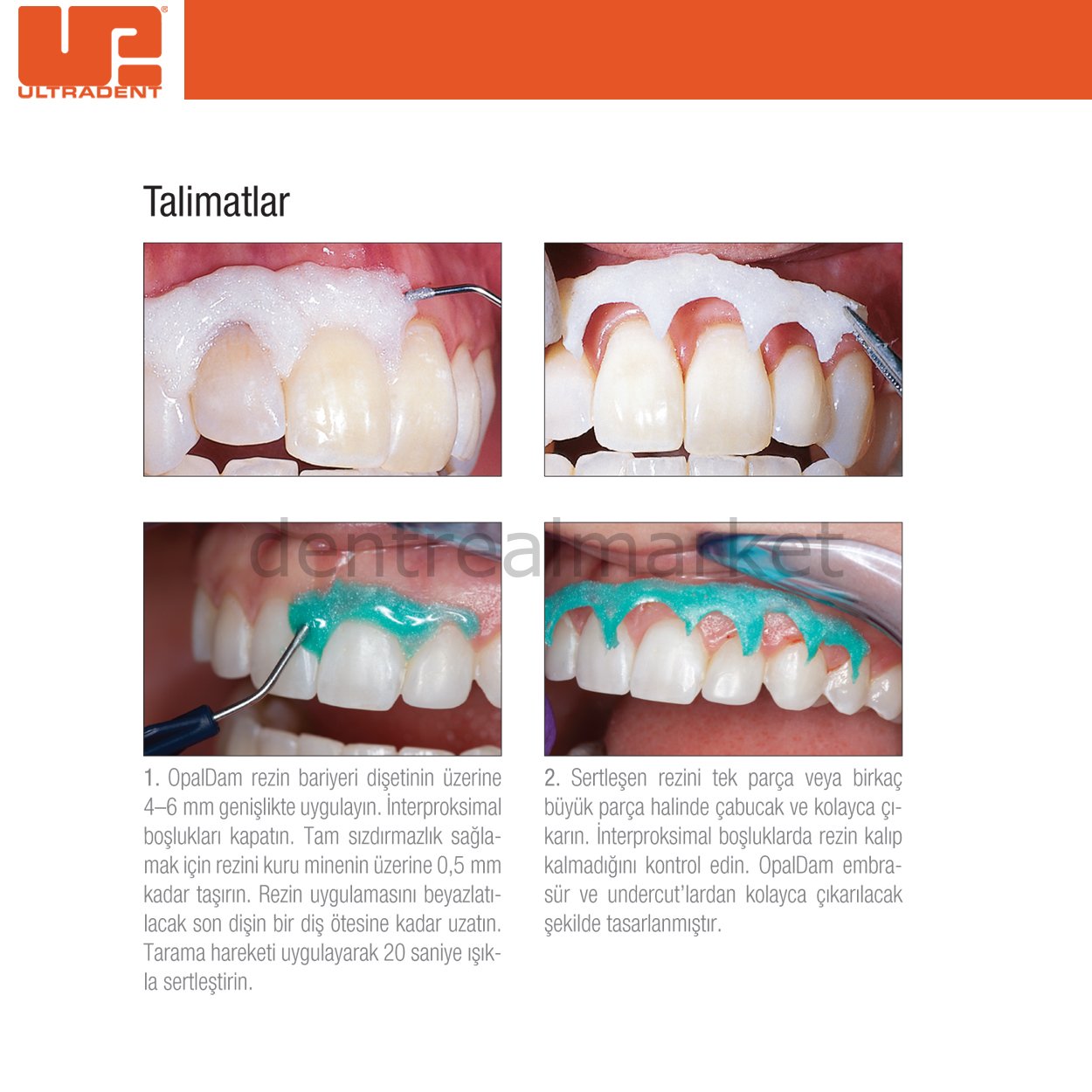 Ultradent OpalDam Green Kit - Gingival Protective Barrier