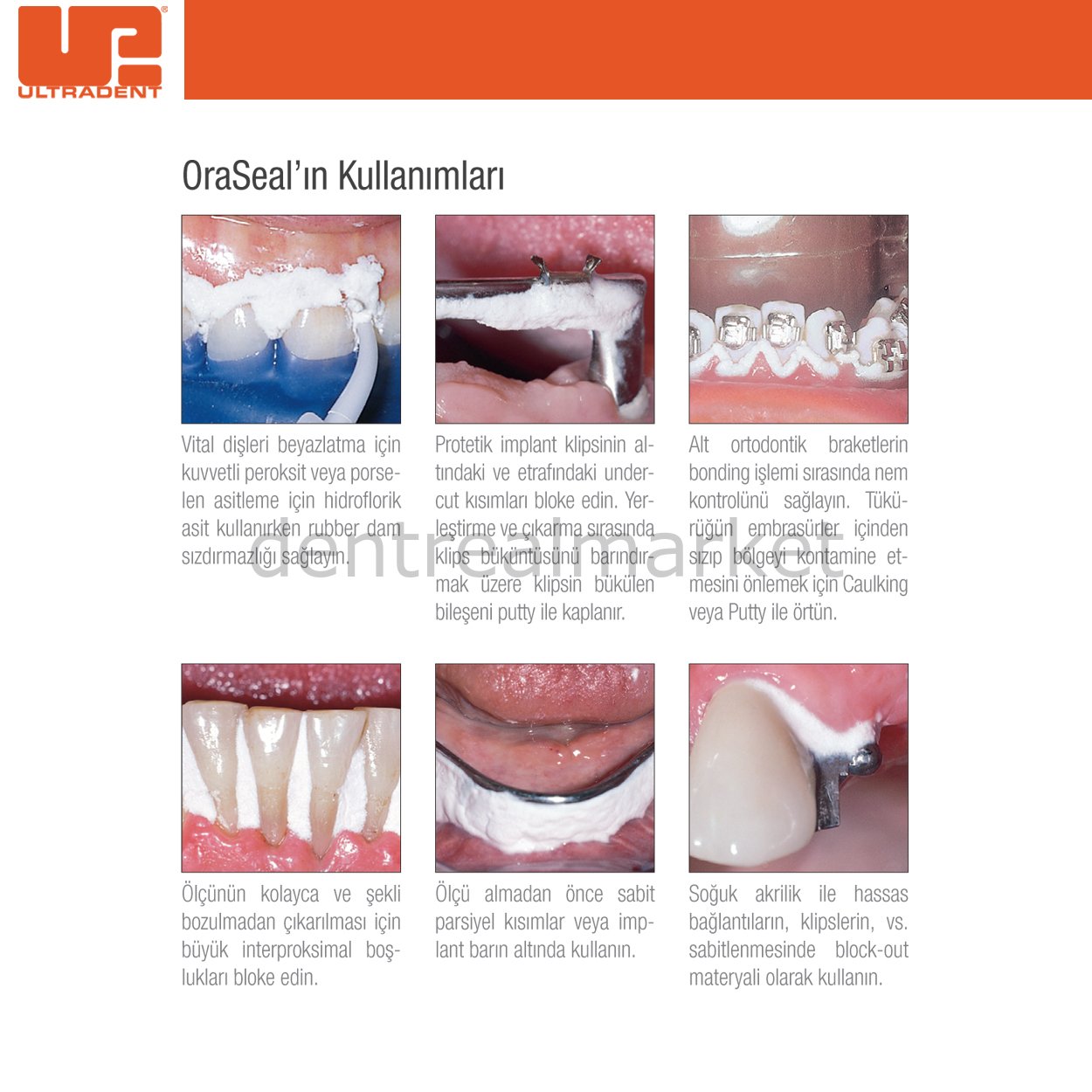 Ultradent OraSeal Putty Refill