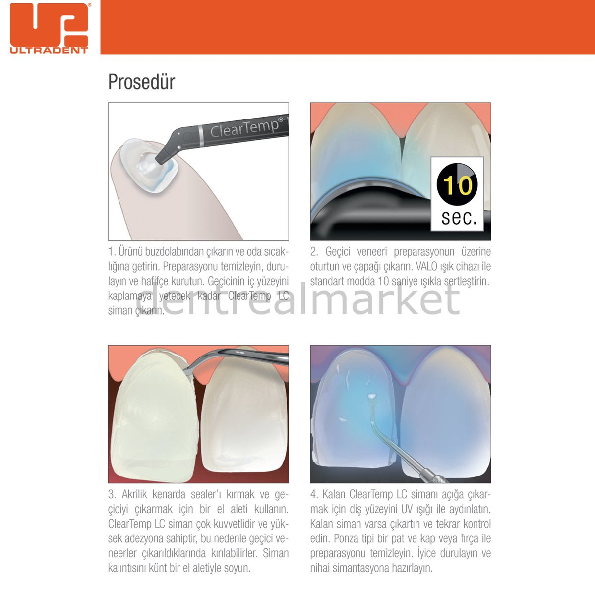 Ultradent ClearTemp LC Temporary Veneer Cement Kit