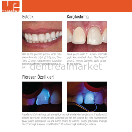 Ultradent ClearTemp LC Temporary Veneer Cement Kit