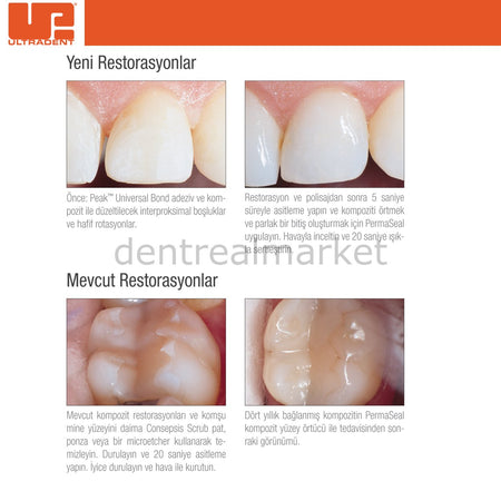 Ultradent PermaSeal Resin Surface Sealant Kit