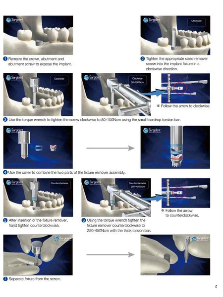 Surgident Single Out Implant Removal Set