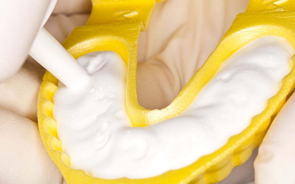 DMG Flairesse Fluoride Foam Gel