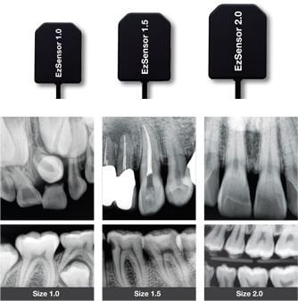 Castellini X-Visus Size 2 Intraoral X-Ray Sensor RVG