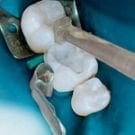 Tdv Dental Foto Plus Composite Contouring Instrument