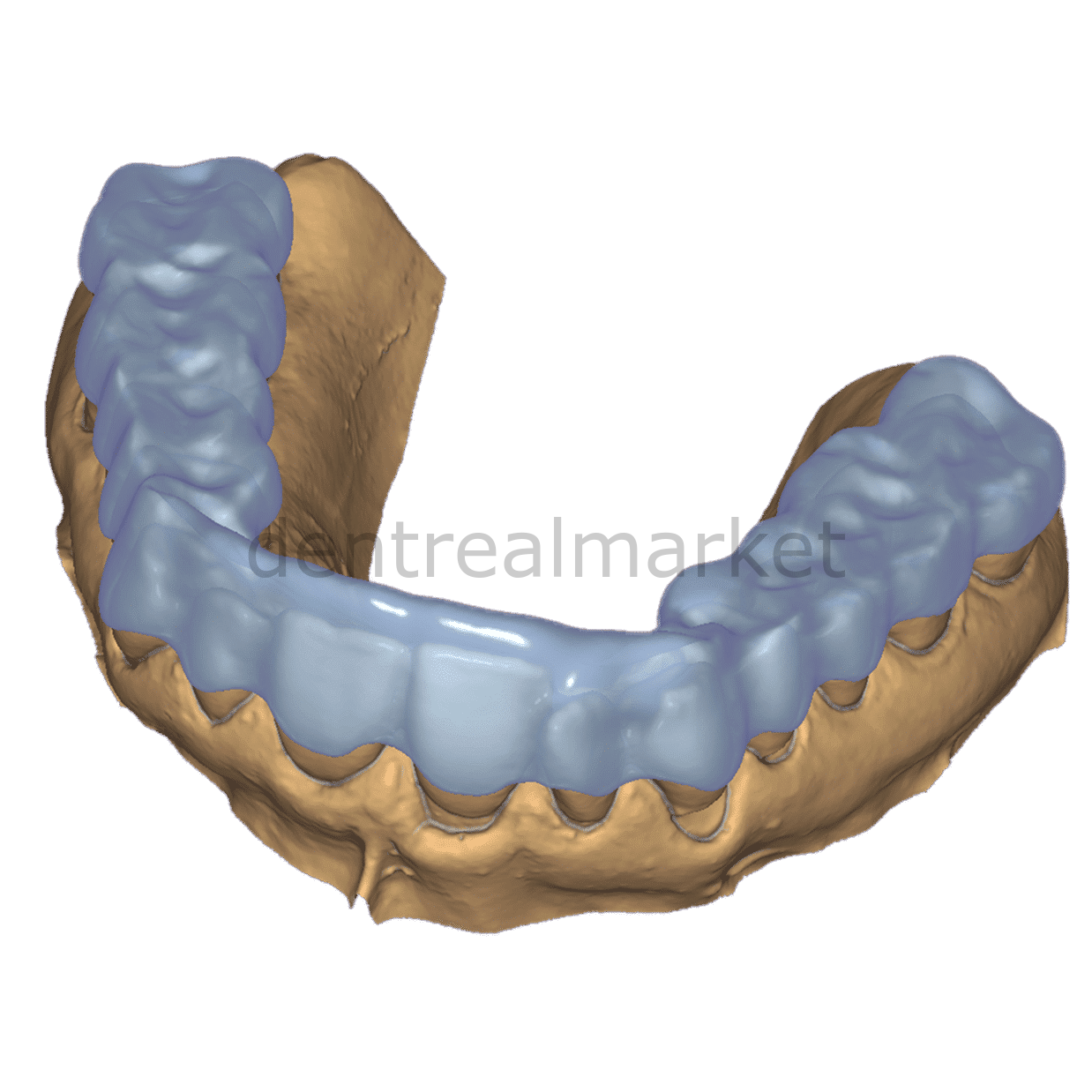 Exocad ChairsideCAD Bite Splint Module