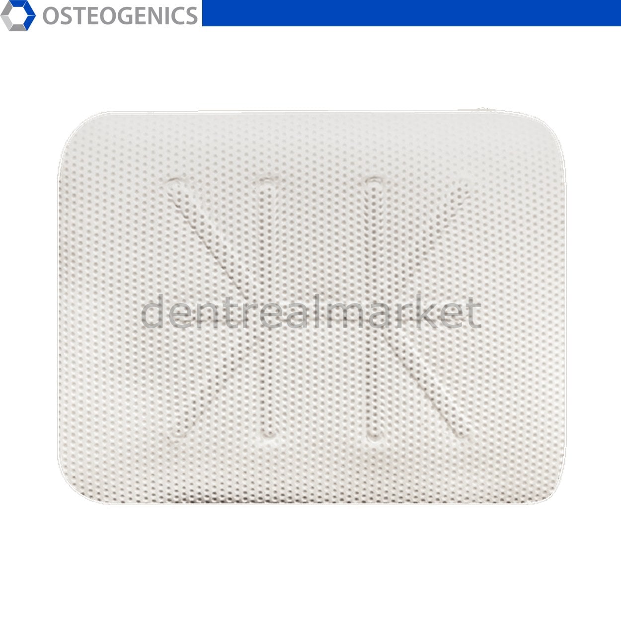 Osteogenics Cytoplast Titanium-Reinforced Membrane — 40 x 50 mm