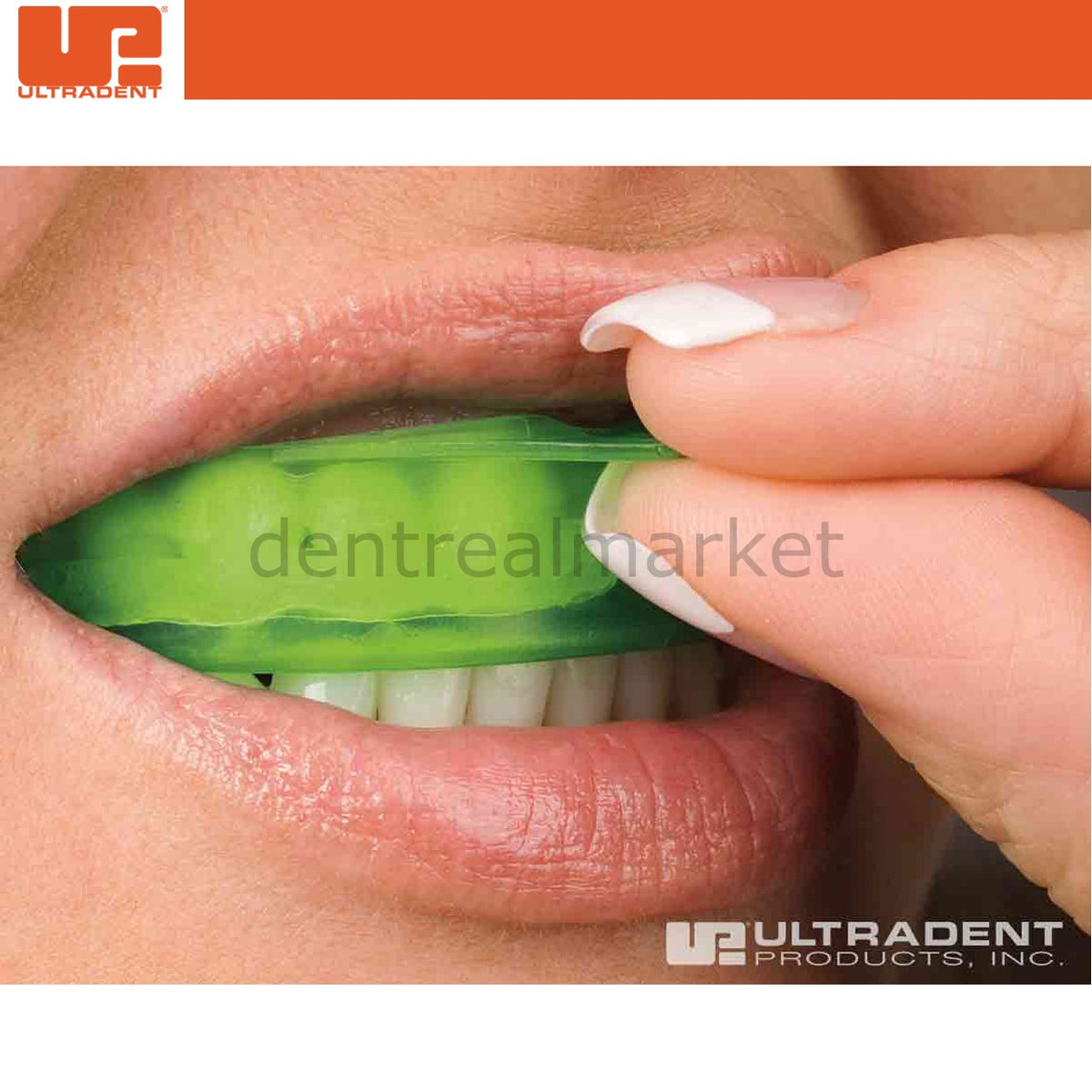 Ultradent UltraEZ Tray Mini Kit Upper/Lower Trays
