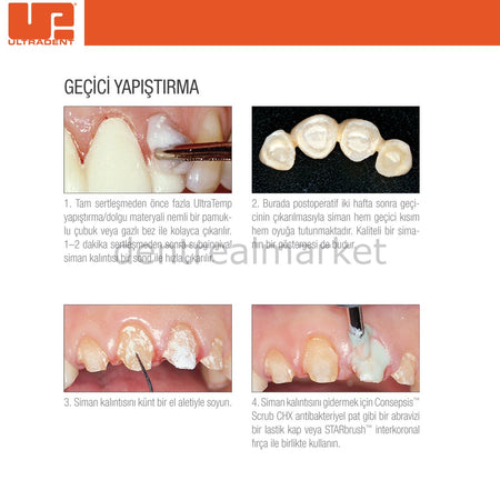 Ultradent UltraTemp Temporary Luting Cement