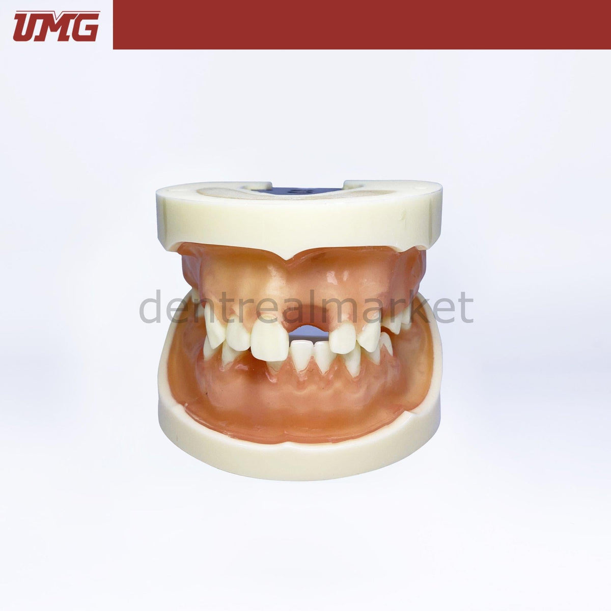 Umgr Ris Umg Dental - Umg Model Implant Training Model Upper-Lower Jaw - UM-2002 ...