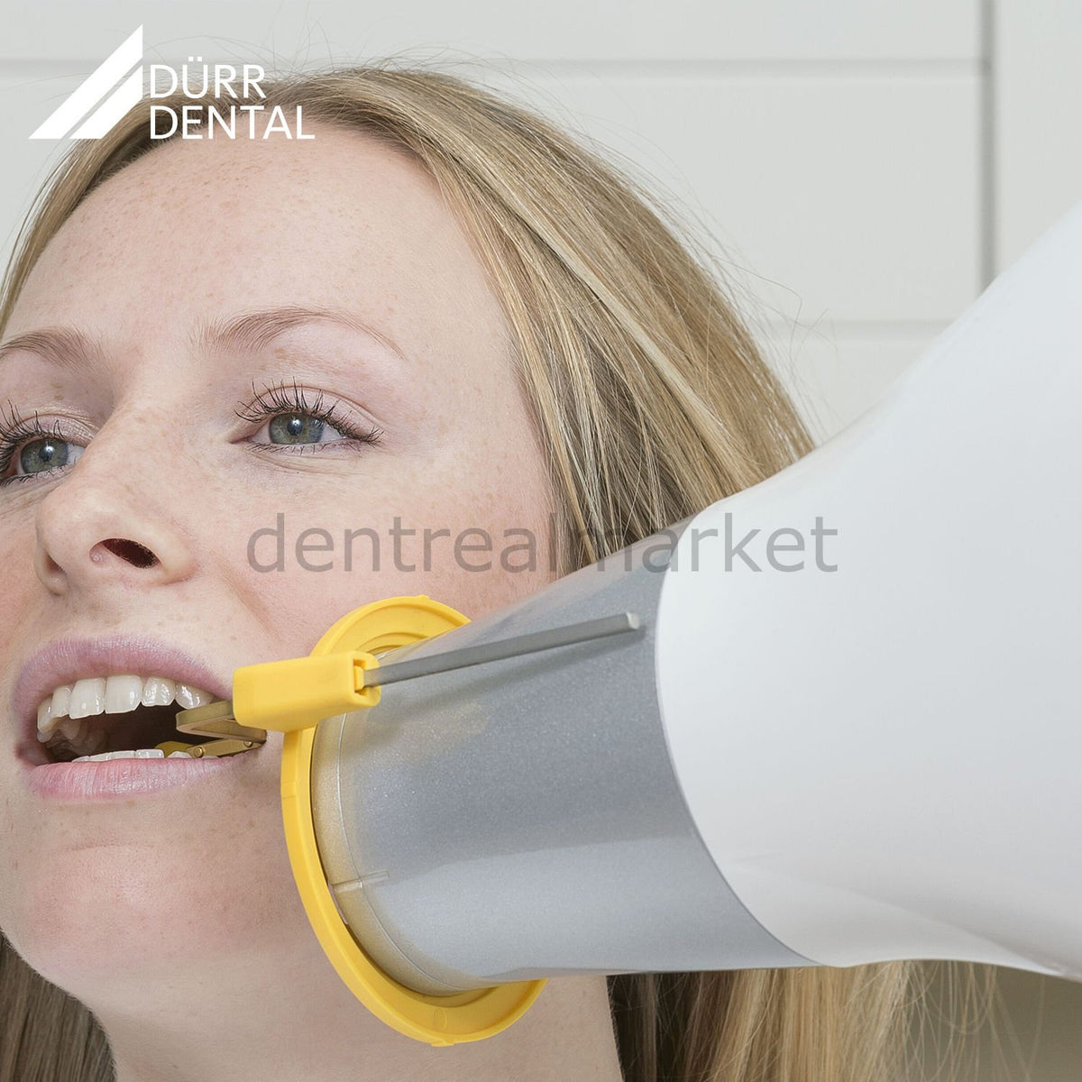 Durr Dental VistaIntra DC Periapical X-Ray