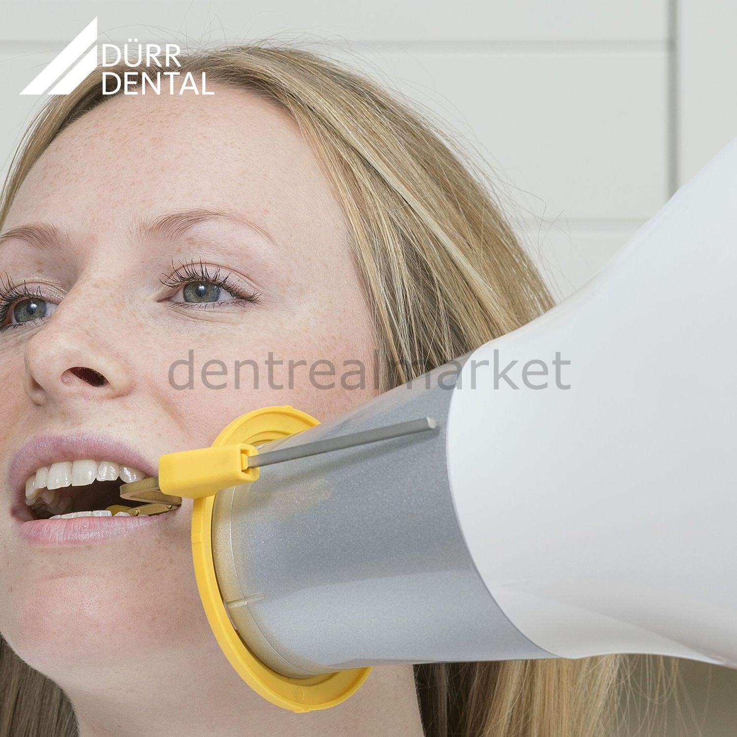 Durr Dental VistaIntra DC Periapical X-Ray