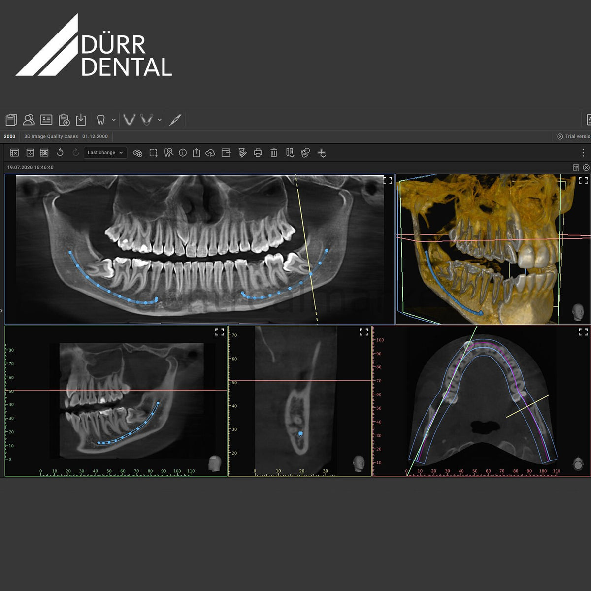 Dürr Dental VistaVox S 3D CBCT and Panoramic X-Ray