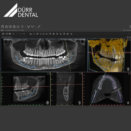 Dürr Dental VistaVox S 3D CBCT and Panoramic X-Ray