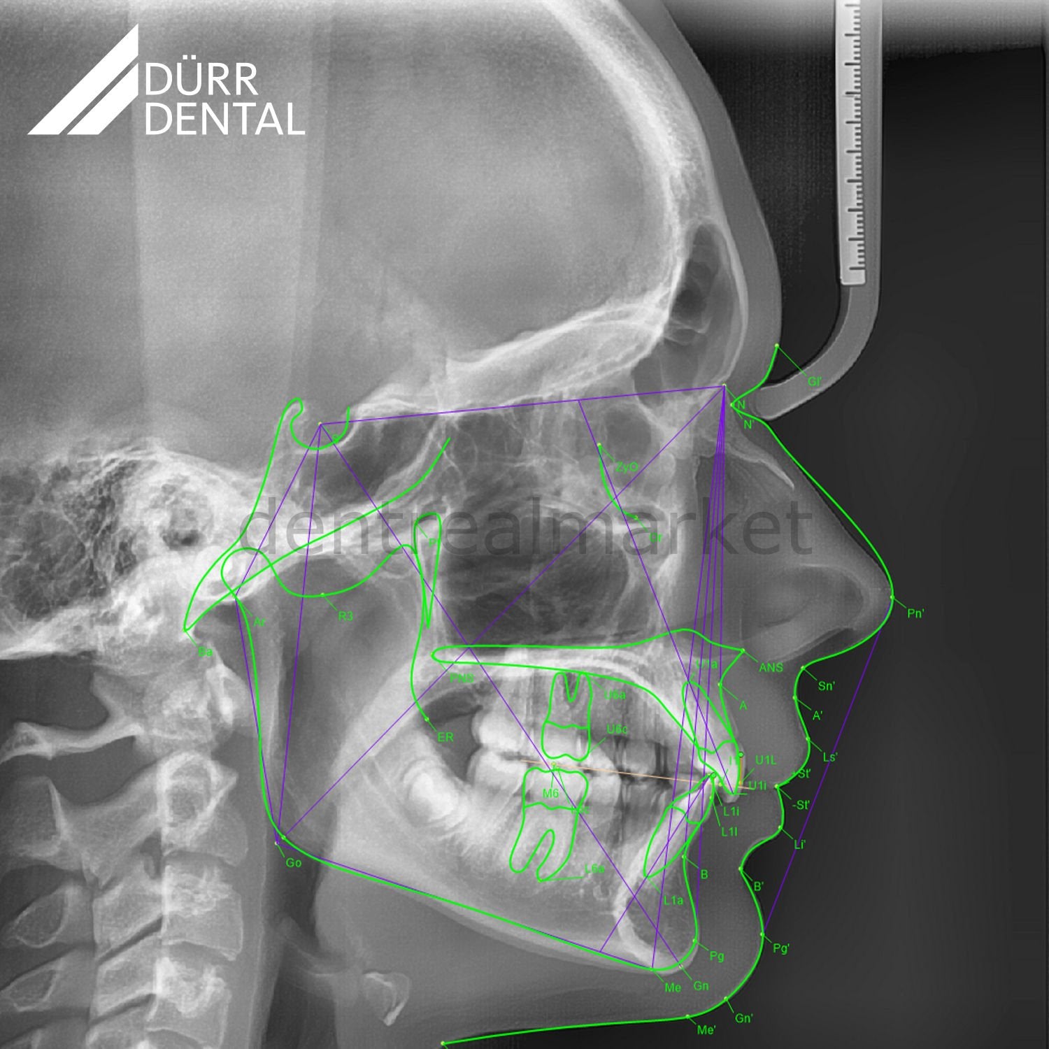 Durr Dental VistaVox S Ceph 3D Volumetric Tomography & Pan & Ceph X-ray