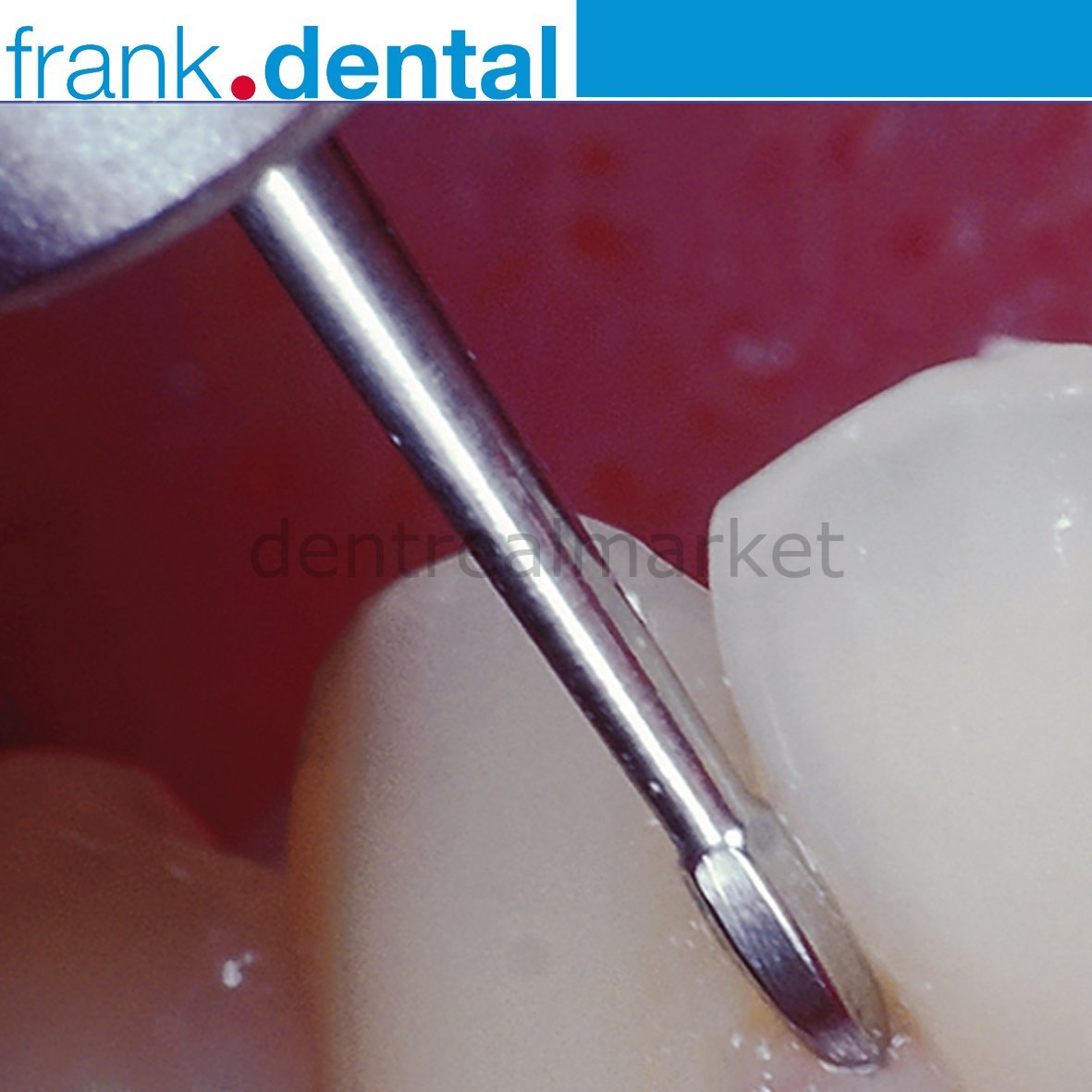 DentrealStore - Frank Dental Perio Bur 758