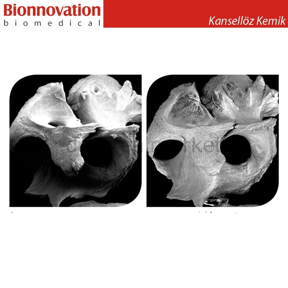DentrealStore - Bionnovation Bonefill Prous (Cancellous) Bovine Graft - Xenograft - 2,5 gr (7cc)