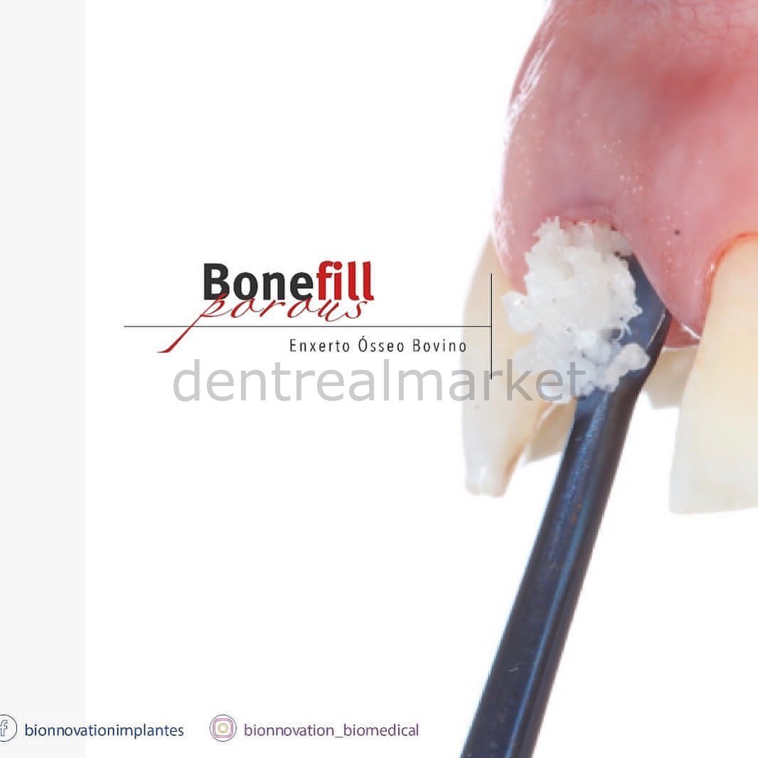 DentrealStore - Bionnovation Bonefill Prous (Cancellous) Bovine Graft - Xenograft - 5 gr (10cc)