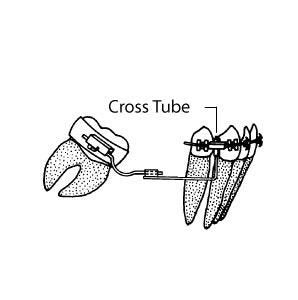 DentrealStore - Dynaflex Cross Tubes Tube - 1 Pcs