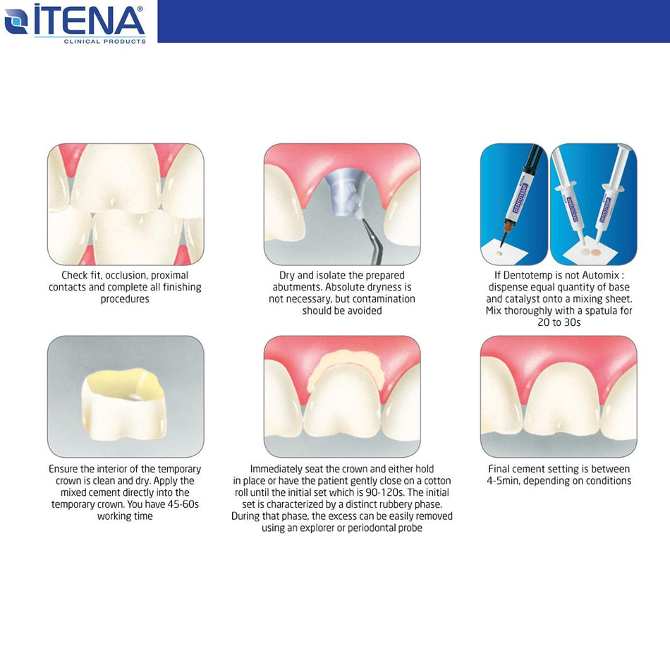 DentrealStore - Itena Dentotemp Long term temporary cement - Special implant - 2 Pcs