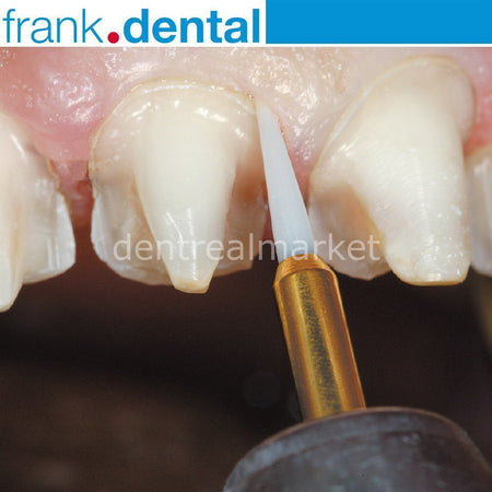 DentrealStore - Frank Dental Soft Tissue Gingiva Trimmer Burs - Ceramic Gingiva Bur - 2 pcs
