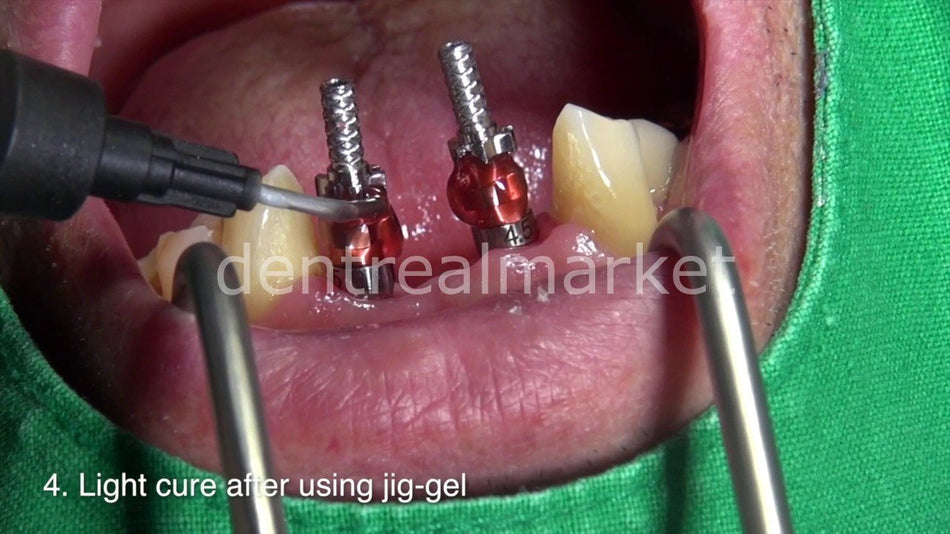DentrealStore - Dentreal Jig Gel Light Cured Pattern Resin 5*12gr