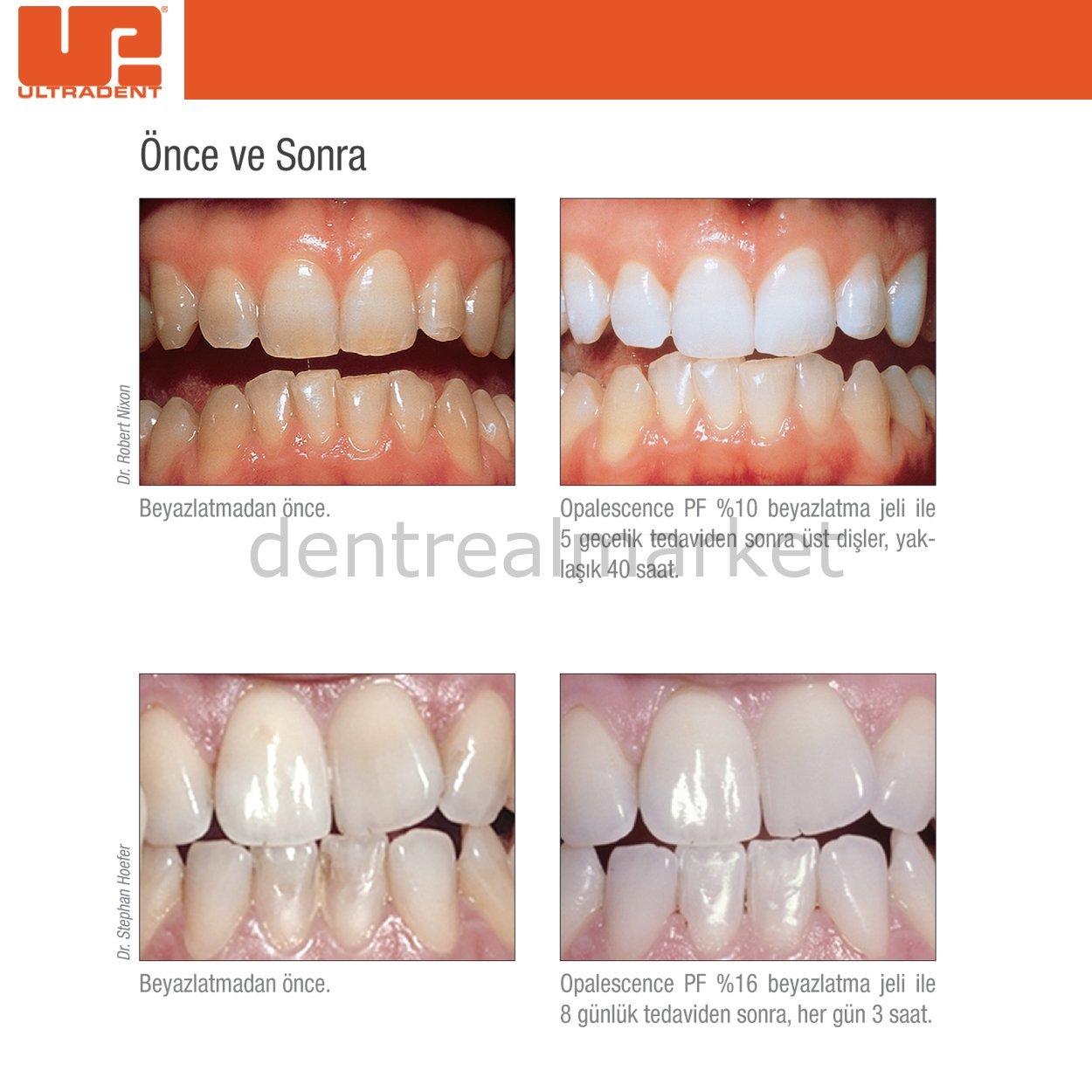DentrealStore - Ultradent Opalescence Tooth Whitening - Carbamide Peroxide-Teeth Whitening at Home