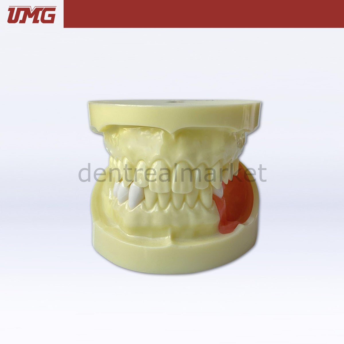 DentrealStore - Umg Dental Umg Model Implant Training Model Upper-Lower Jaw - UM-Z4