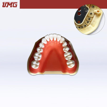 DentrealStore - Umg Dental Umg Model Removable Teeth Training Model Lower - Frasaco Compatible - UM-A2F
