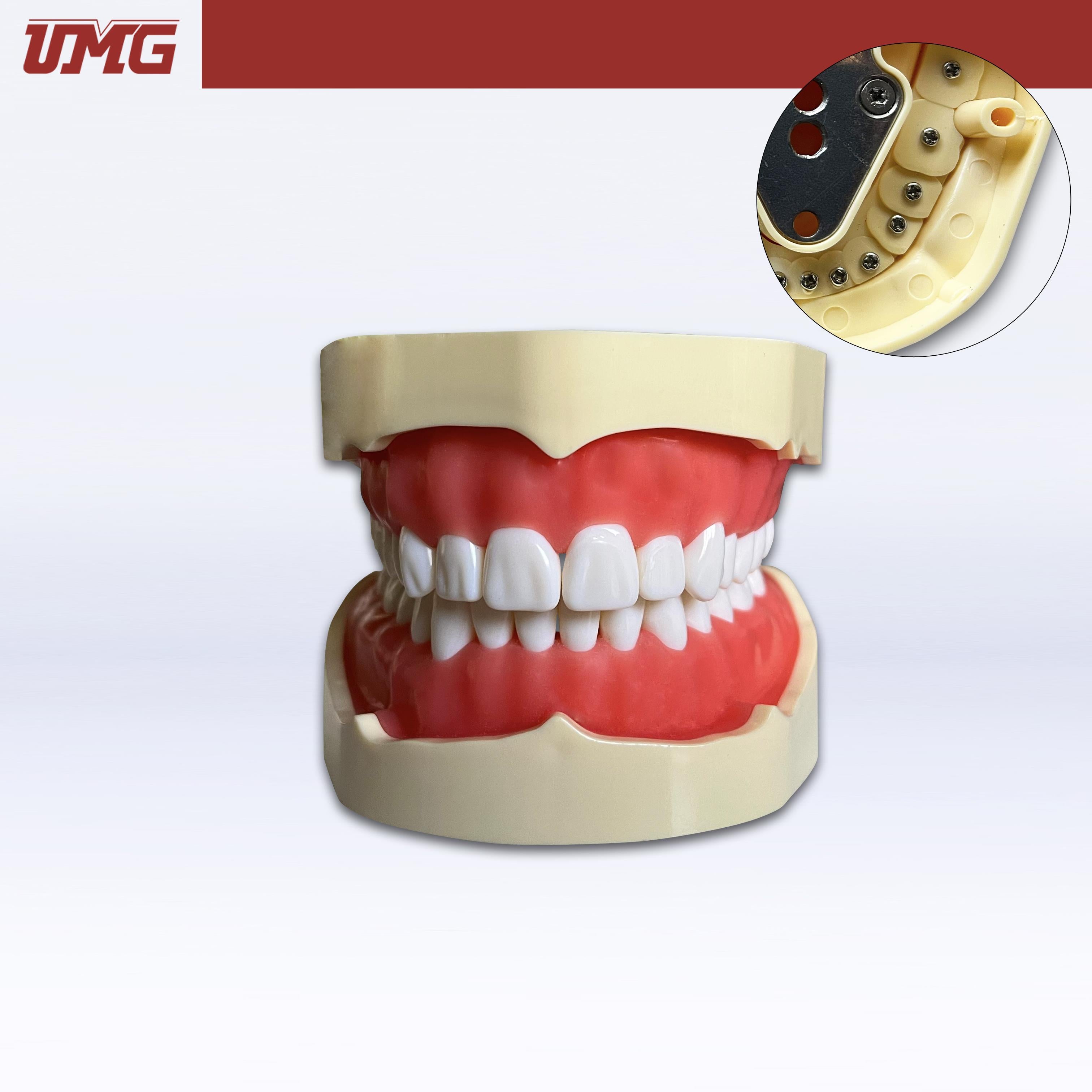 DentrealStore - Umg Dental Umg Model Removable Teeth Training Model Upper Lower Jaw Set - Frasaco Compatible - UM-A2F