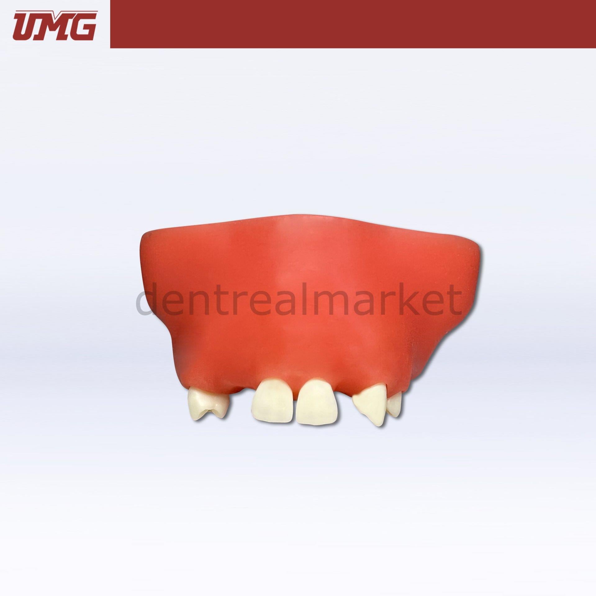 DentrealStore - Umg Dental Umg Model Sine Lift Training Model - UM-2014